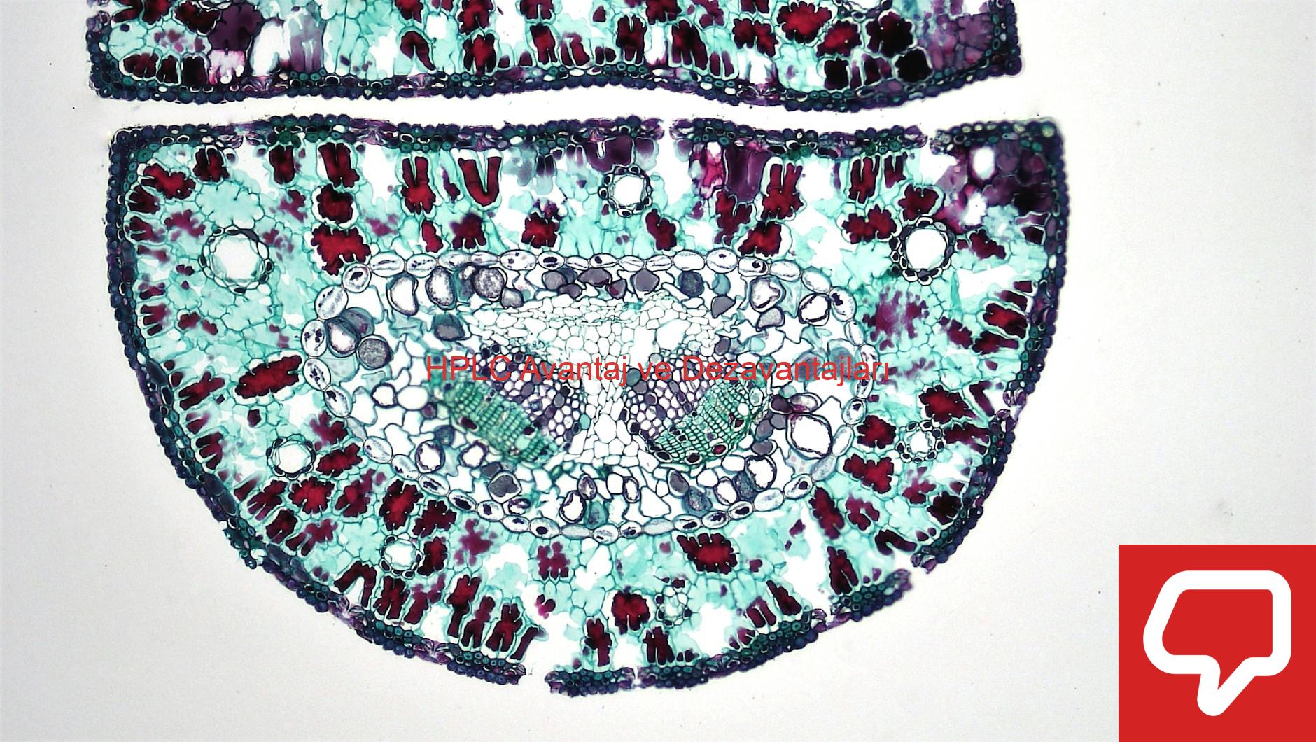 HPLC Avantaj ve Dezavantajları